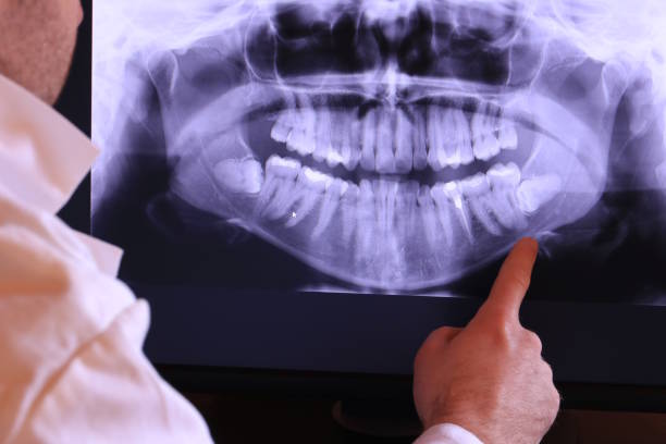 Best Emergency Wisdom Teeth Removal in Bon Aqua Junction, TN